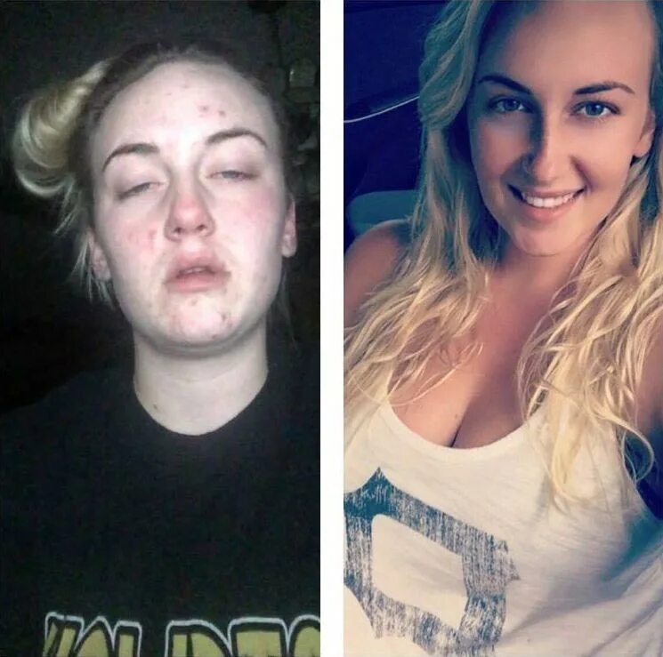 Бросившие пить фото. Лицо до и после наркотиков. Лица наркоманов до и после. Люди которые употребляли наркотики до и после.