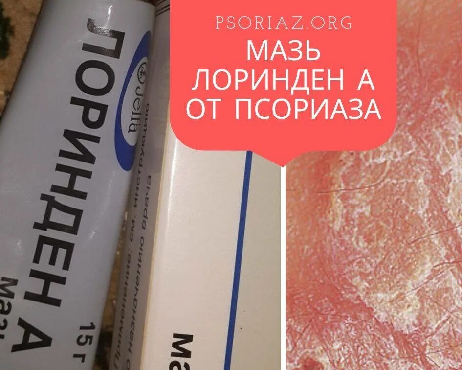 Magnified psoriasis on arm 296347 Vector Art at Vecteezy