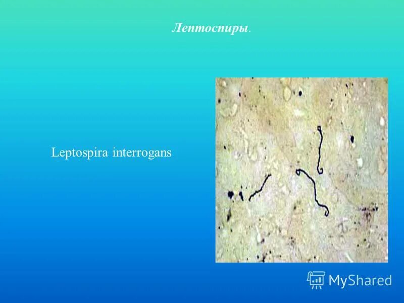 морфология спирохеты лептоспиры. Leptospira interrogans окраска. лептоспироз микробиология. лептоспироз антигенная структура. лептоспироз микробиология.