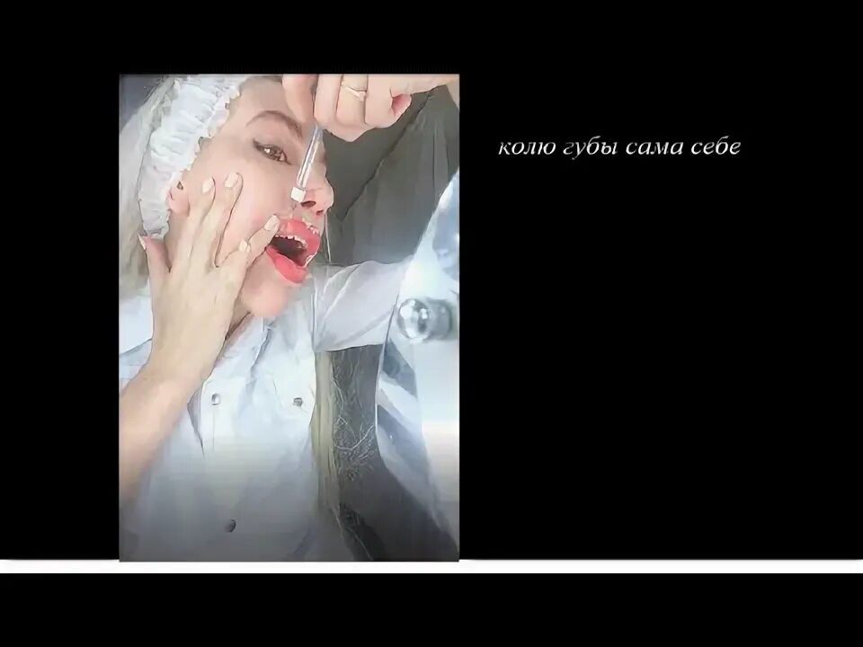 Филлер сама себе. Dr Alana. Девушка которая колола себе цемент.