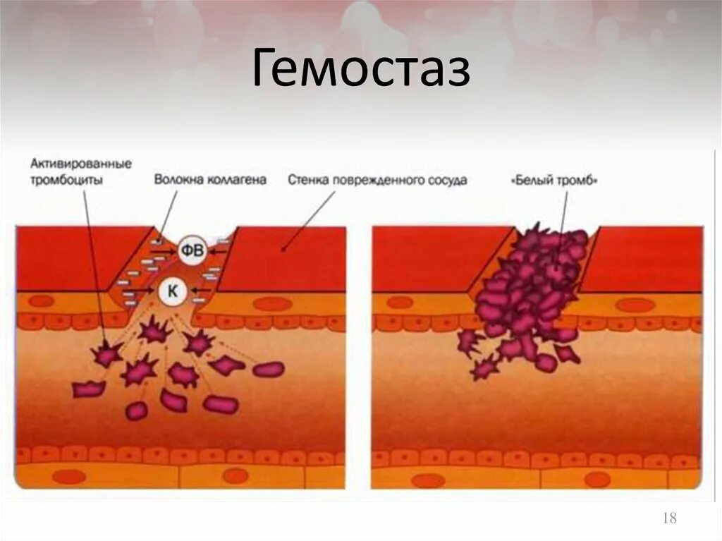 Гемостаз образование тромбоцитарного тромба и. Механизм адгезии тромбоцитов. Тромбоциты крови тромб образование. Повреждение кровеносного сосуда формирование тромба.