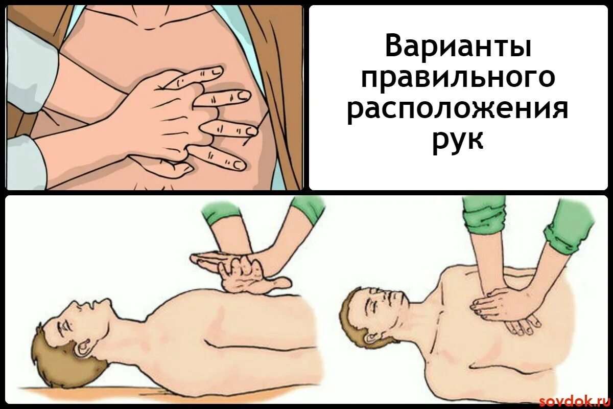 Как правильно реанимировать