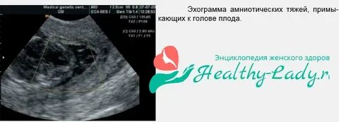 Ш рстка тяж лый защ лка
