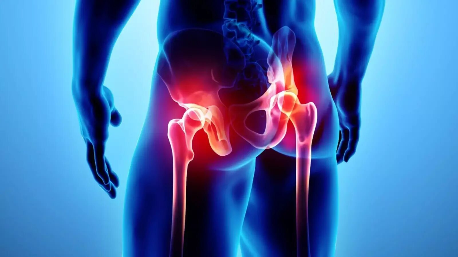 Hip Joint Pain. Коксалгия тазобедренного сустава. Тазобедренный сустав болит. Бдль тазобедренный сустав.