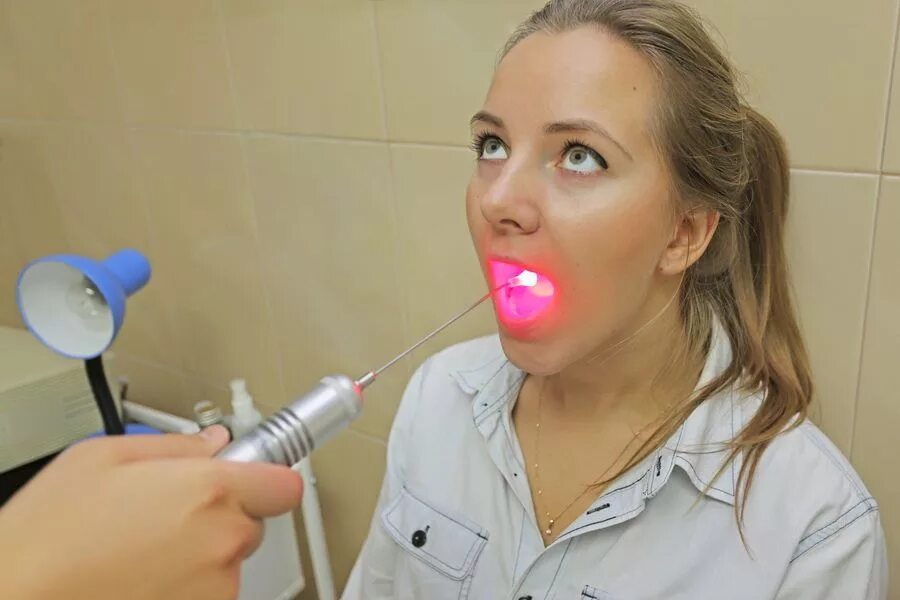 лечение тонзиллита лазером. холодноплазменная тонзиллэктомия. лазерная терапия миндалин. ак криомед криодеструктор. промывание лакун миндалин аппаратом интра-лор.