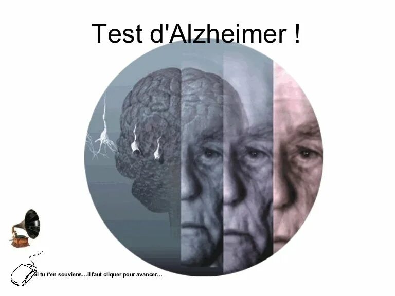 Тест альцгеймера сколько лиц на картинке. Мозг в старости. Старение мозга. Альцгеймер снимок мозга. Болезнь Альцгеймера иллюстрация.