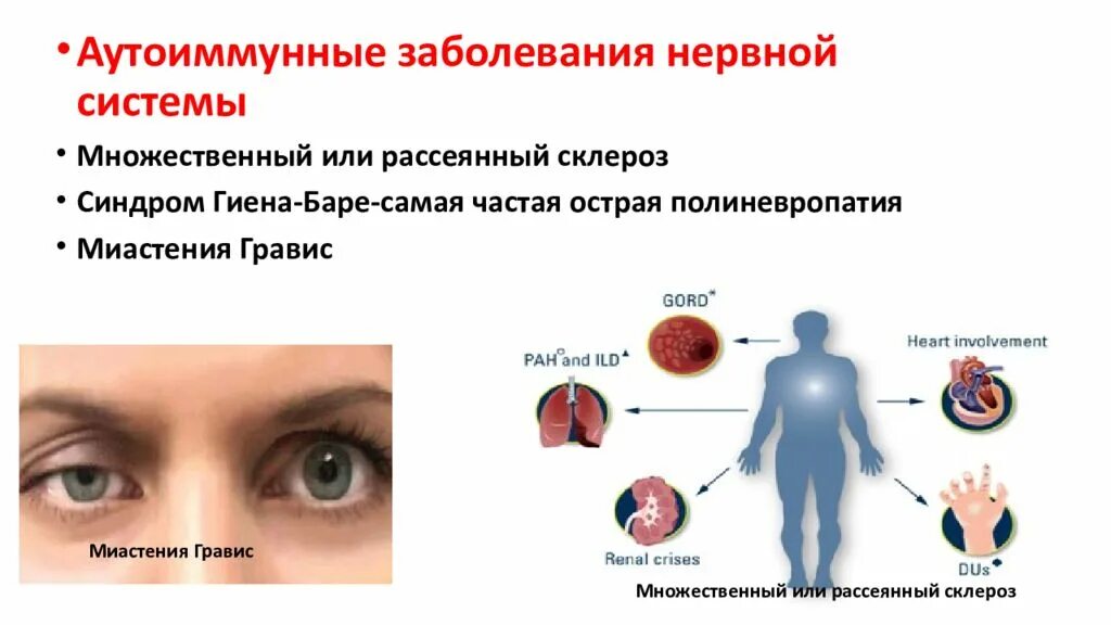 Аутоиммунные заболевания. Аутоиммунные заболевания нервной системы. Заболевание аутоиммунной системы. Аутоиммун не заболевания. Аутоиммунных осложнений