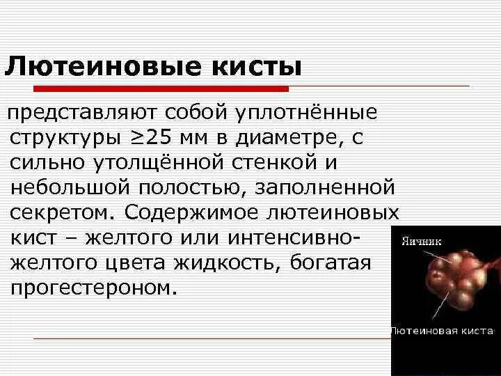 Лютеиновая киста яичников. Лютеиновые кисты яичников.