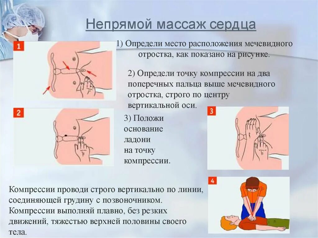 Точка приложения рук при проведении непрямого массажа сердца. Правильное исполнение непрямого массажа сердца. Алгоритм проведения наружного непрямого массажа сердца. Точка для проведения непрямого массажа сердца у взрослых. Как проводится непрямой массаж сердца