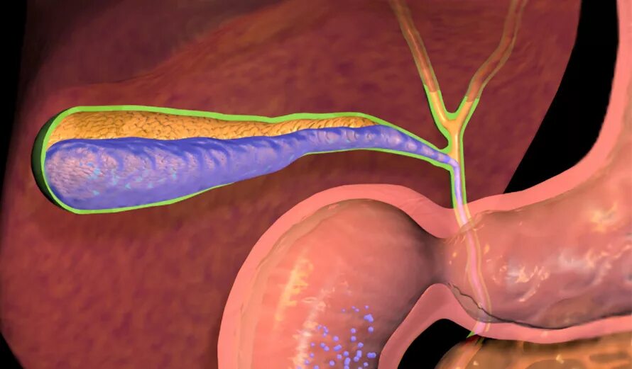 Симптомы плохой желчи. Хронический некалькулезный холецистит. Холецистит застой желчи. Холангит желчевыводящих путей. Дисхолия желчного пузыря что это такое.