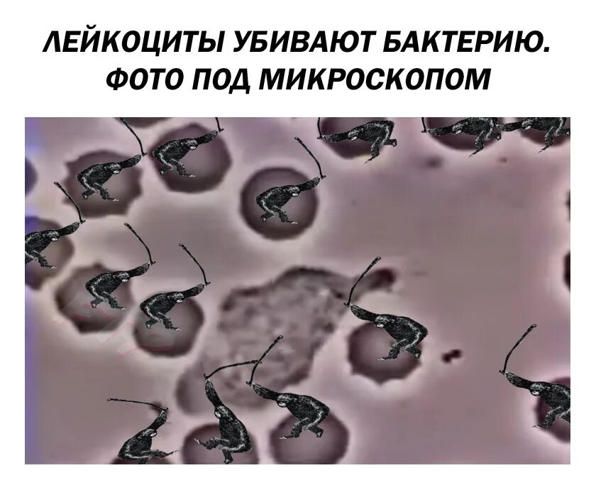 Какие микробы убивают. Гибель микроба. лейкоциты убивают бактерии. лейкоциты и бактерии под микроскопом. лейкоциты под микроскопом.