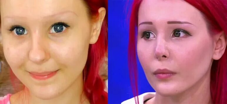 Какие операции сделала Анастасия Шпагина?