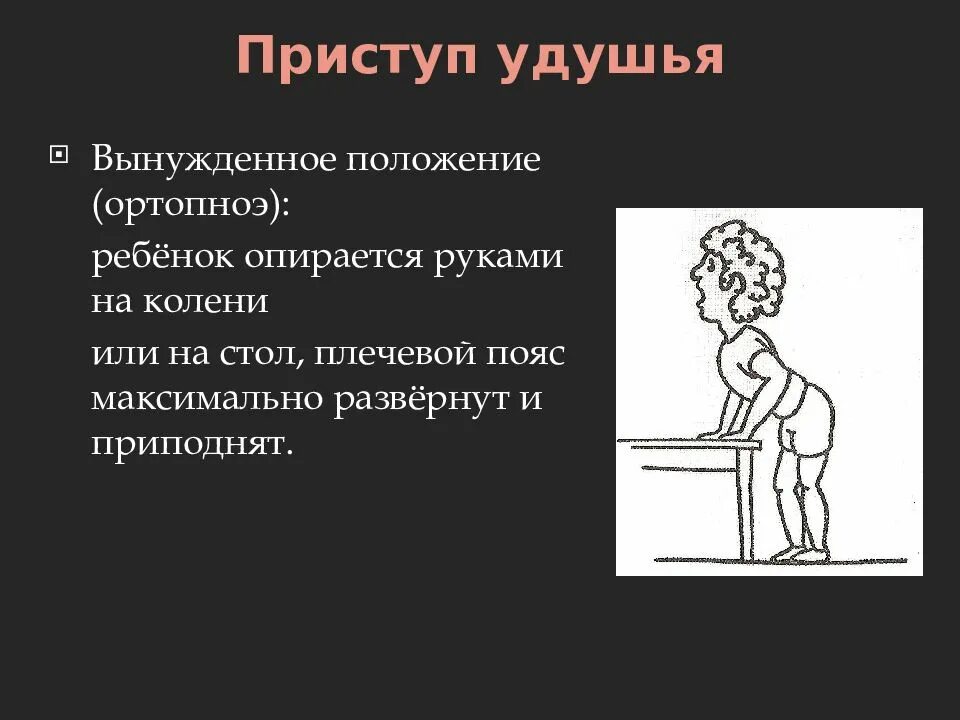 Положение больного при бронхиальной астме. Вынужденное положение при бронхиальной астме. положение ортопноэ при бронхиальной астме. положение пациента при приступе удушья. положение ребенка при приступе бронхиальной астмы.