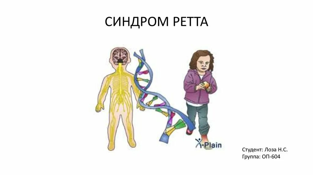 Синдром ретта причины. Синдром ретта. синдром ретта презентация. синдром ретта стадии. синдрома андерса ретта.
