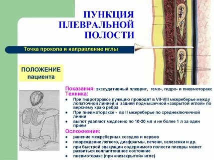 Назначили пункцию
