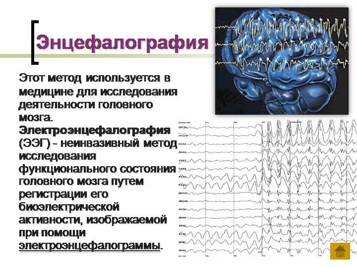 Ээг 7. ЭЭГ головного мозга методика проведения. Функциональные пробы ЭЭГ. Биоэлектрическая активность головного мозга. Ритмы ЭЭГ.. ЭЭГ описание метода.