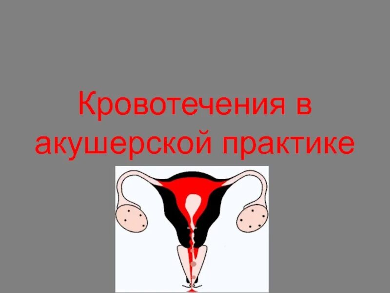 Кровотечения в акушерстве. Акушерские кровотечения. презентация на тему акушерские кровотечения. массивное акушерское кровотечение. кровотечения в гинекологии презентация.