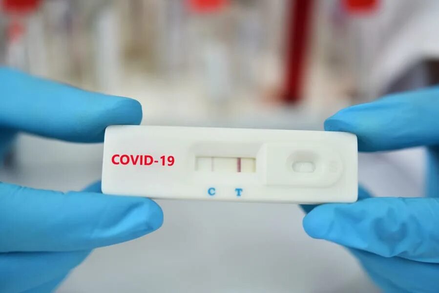 Положительный результат лечения. Rapid Test covid19. Тест на коронавирус. Положительный результат картинка. Экспресс-тест на коронавирус Covid-19.