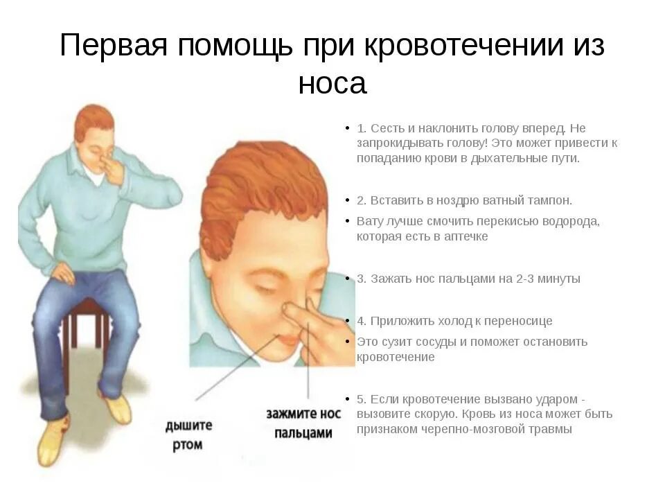 Какое положение при носовом кровотечении. При кровотечении из носа. При кровотечении из носа необходимо. Какостанововить носовое кровотечение. Остановка кровотечения из носа.