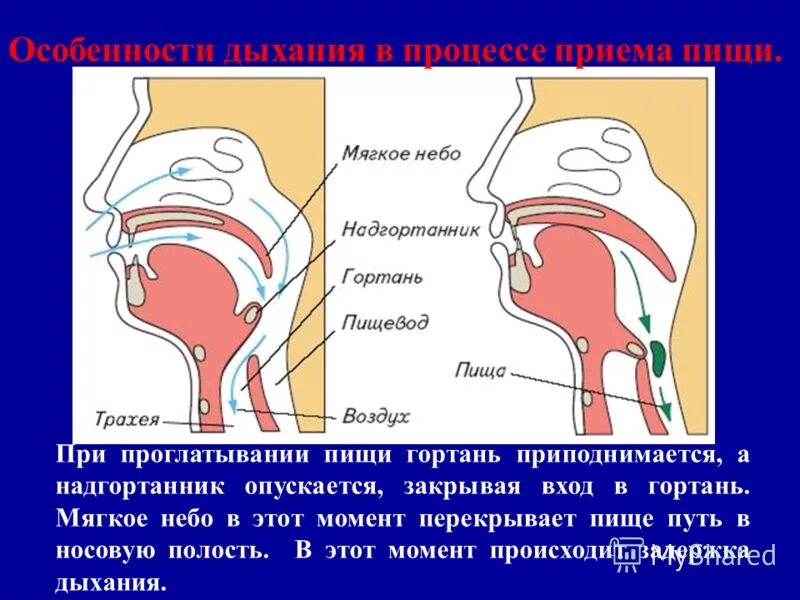 При глотании ощущение инородного. Попадание пищи в гортань. Пища попала в дыхательные пути.