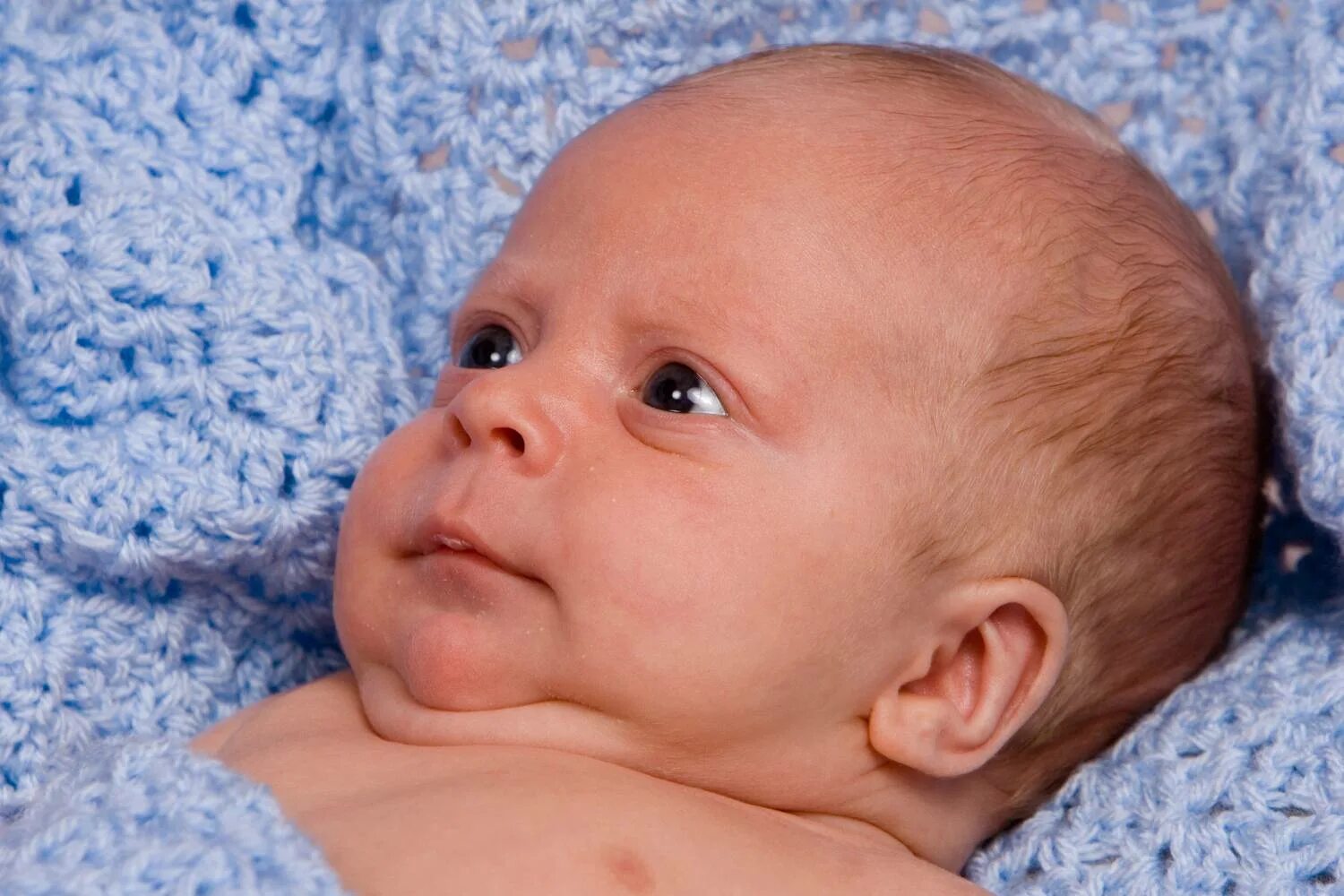 Маленький затылок. Гидроцефалия головного мозга у ребенка. Гидроцефалия у новорожденного. Курносый младенец.