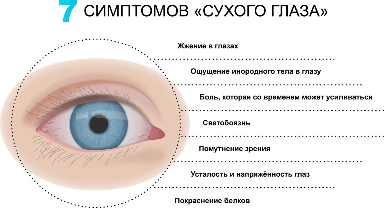 Причины развития синдрома сухого глаза. ССГ (синдром сухого глаза. Синдром сухого глаза профилактика. Причины возникновения синдрома сухого глаза. 7 ощущается как