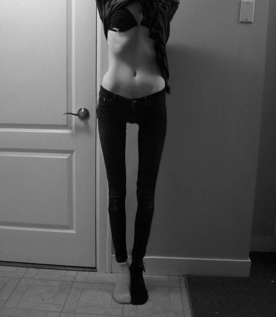 Аня жолобова анорексия. Худые девушки. Худые девочки с разговорами. Худые девочки с разговорами. Худощавая девушка.