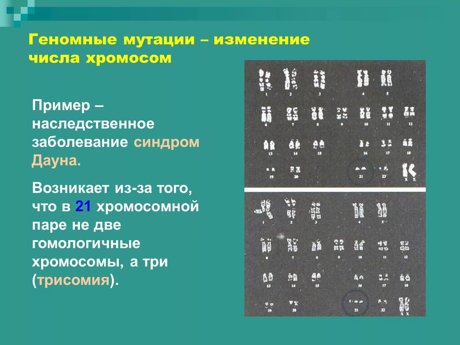 Изменение количества хромосом мутация. При синдроме Дауна изменяется число хромосом группы. Синдром Дауна геномная мутация. Геномные мутации изменение числа хромосом. Трисомия это геномная мутация.