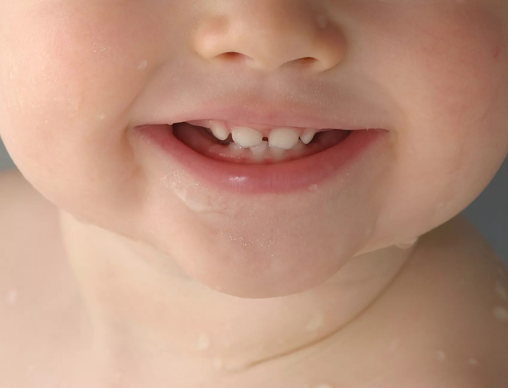 Прорезывание 8 зуба у детей. Маленькие молочные зубы. Маленькие дети с зубами.