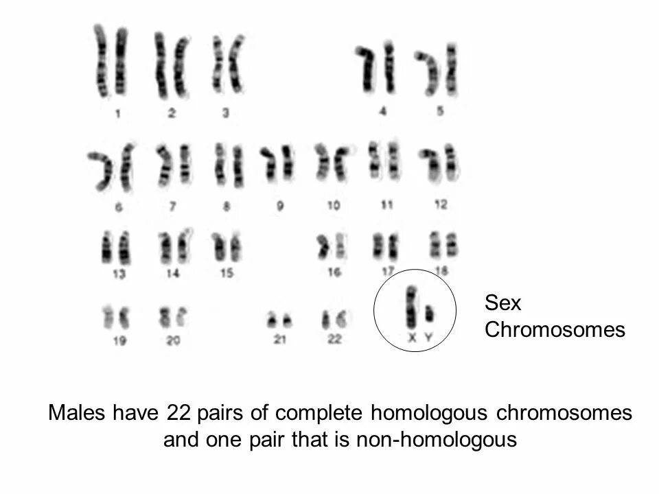 Отсутствие х хромосомы у мужчин. Нормальный кариотип человека 46 хромосом. Мужской кариотип 46 XY. 46,XY нормальный мужской кариотип. Хромосомная карта кариотип.