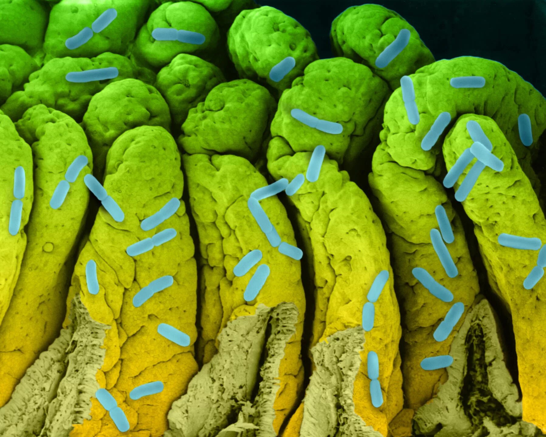 Бактерии под микроскопом. Бактерии кишечника под микроскопом. Желтые бактерии. Микрофлора кишечника под микроскопом.