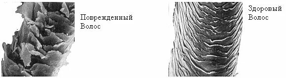 Как определить повреждение волос. Строение волоса чешуйки. строение волоса человека чешуйки. структура волоса здорового и поврежденного. чешуйки волос под микроскопом.