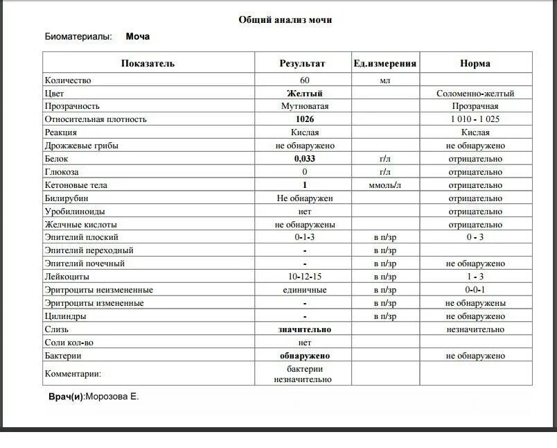 Результат мочи расшифровка у взрослого. Норма показателей общего анализа мочи у женщин таблица. Общий анализ мочи расшифровка у женщин после 50 норма таблица. Анализ мочи расшифровка у женщин после 50 таблица норм. Анализ мочи ОАМ расшифровка у мужчин норма в таблице.
