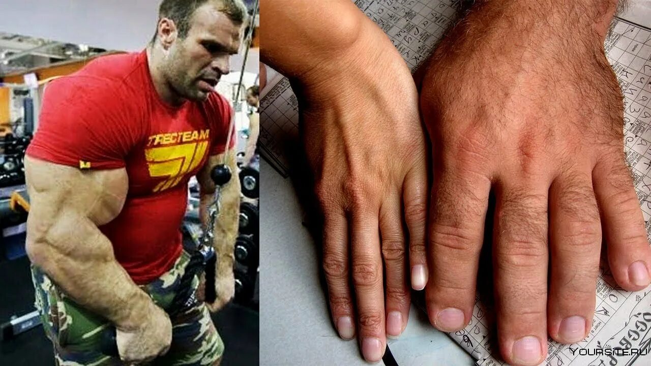 Денис иванович цыпленков руки. Можно ли руку. Денис иванович цыпленков. Удлинение ногтевого ложа. Короткие тонкие пальцы.