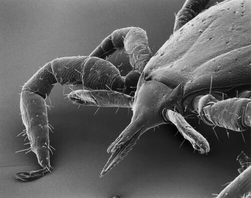 Клещ лапки. Клещ Энцефалитный микроскоп. Хоботок клеща под микроскопом. Хоботок иксодового клеща. Клещ под микроскопом Энцефалитный.