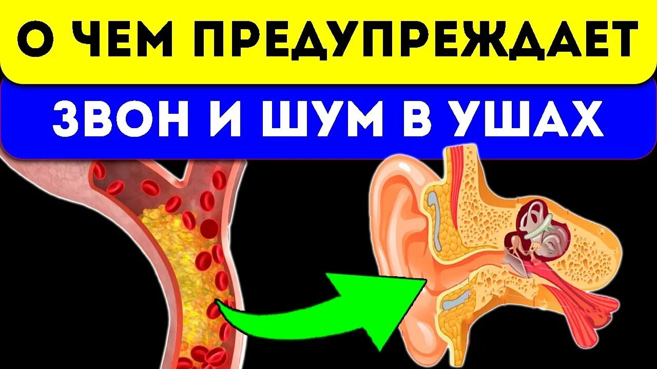 Почему слышно шум в ушах. Шум в ушах причины. Звон в ушах причины. Постоянный шум в ушах причины. Тиннитус шум в ушах.