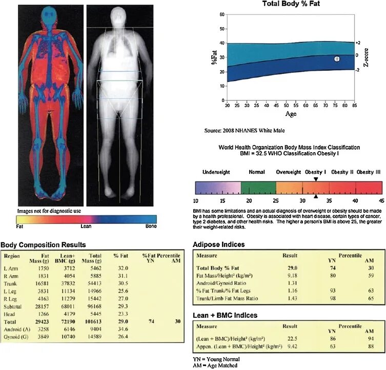 Денситометрия тотал боди. Таблица машин на нюрбургринге. Weider логотип тренажеры. Total weight. Weider utility bench.