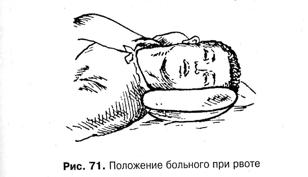 Оказание помощи пациенту при рвоте. Положение больного при рвоте. Оказание пациенту помощи при рвоте без сознания. Положение головы больного на бок. Оказание помощи при рвоте алгоритм