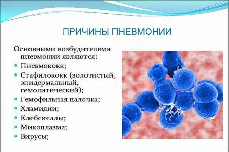 Пневмония симптомы как распознать