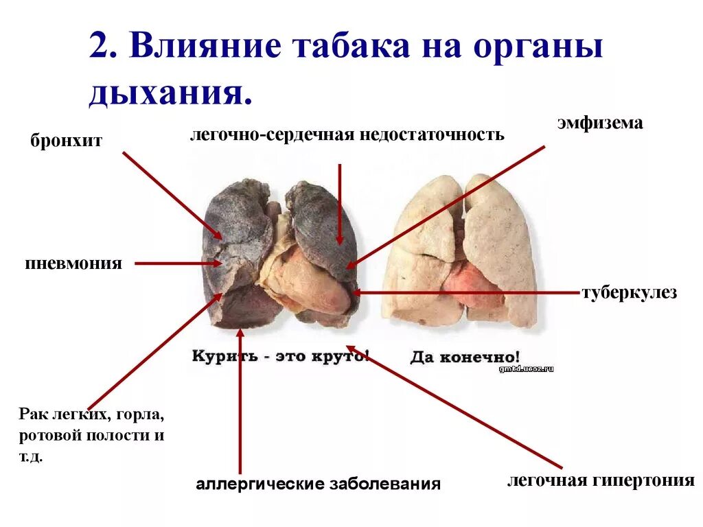 Влияние табачного дыма на органы дыхания. Влияние сигарет на дыхательную систему. Влияние курения табака на дыхательную систему. Как влияет курение табака на дыхательную систему. Почему уменьшается легкое