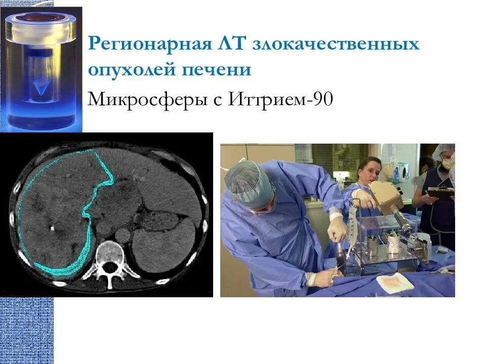 Терапия рака печени. Лучевая терапия злокачественных опухолей. Радиотерапия злокачественных новообразований. Методы лучевой терапии злокачественных опухолей. Лучевая терапия печени.