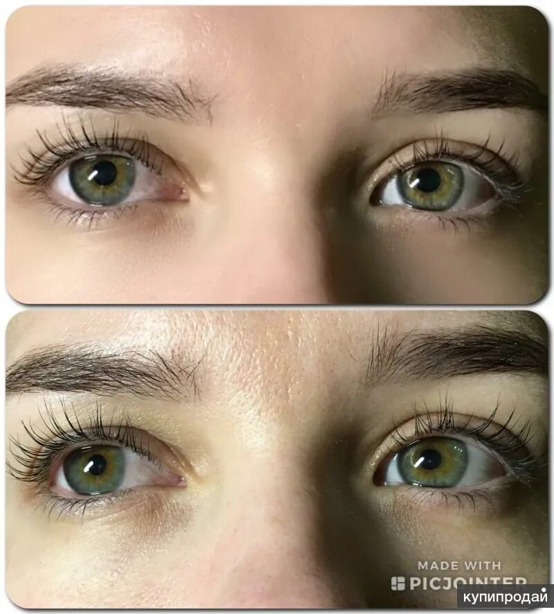 Ботокс ресниц- суть и преимущества процедуры Botox lashes