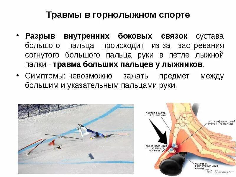 Как избежать разрывов. Лыжные травмы. Травмы в лыжном спорте. Травмы при лыжном спорте. Причины спортивных травм.