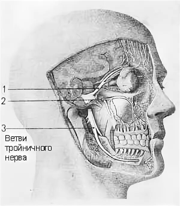 Как проверить тройничный нерв. Воспаление тройничного нерва на кт. лицевой нерв. лицевой нерв мрт. тройничный нерв мрт анатомия.