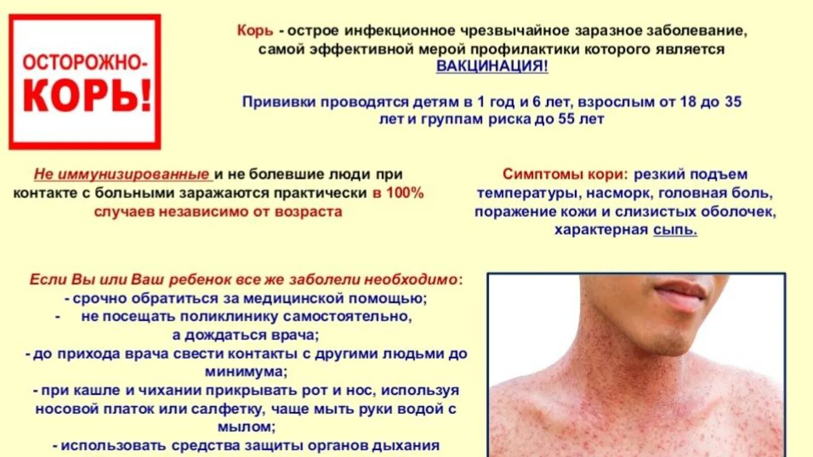 Привитые от кори могут заболеть корью. Инфекционное заболевание корь.