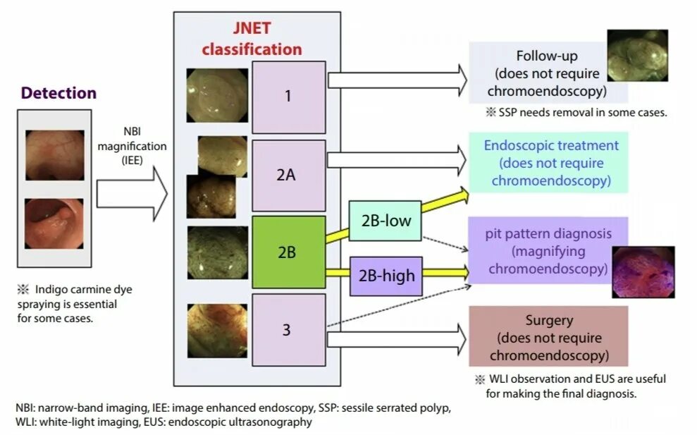 JNET классификация. Классификация по Kudo. JNET классификация эндоскопическая. Kudo эндоскопия классификация. Классификации эндоскопия