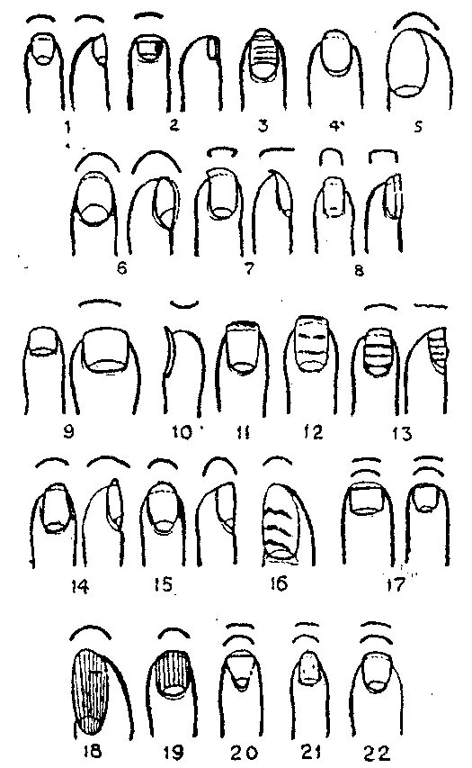 О чем говорит форма ногтей. Формы натуральной ногтевой пластины. Типы и формы ногтевых пластин. Формы пластины ногтей. Форма ногтей на руках.