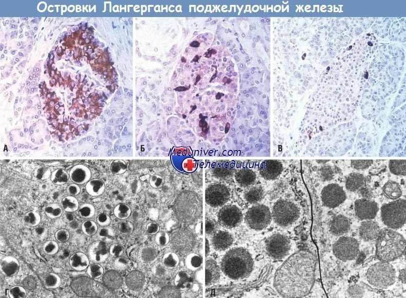 Клетки островков Лангерганса гистология. Островки Лангерганса поджелудочной железы гистология. Клетки Лангерганса поджелудочной железы. Островки Лангерганса поджелудочной железы препараты.