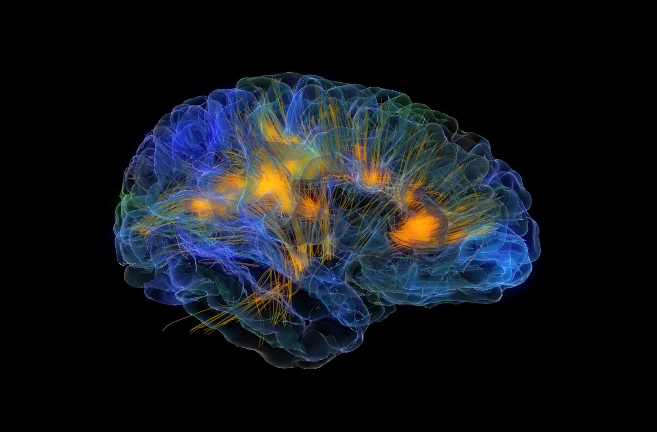 Красивый мозг. Brain imaging