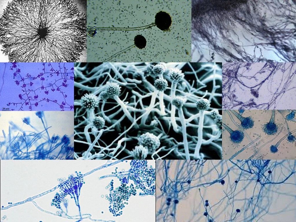 Патогенные грибы споры. Мицелий и псевдомицелий. Мицелий грибов микроскопия. Микоз кожи микроскопия. Грибы кандида микроскопия.
